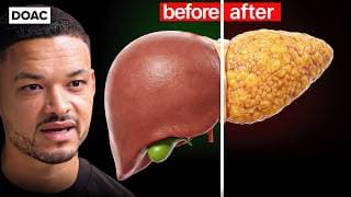 If You Eat THESE "Healthy" Foods, You NEED To See This