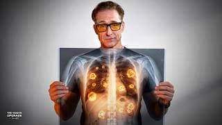 Your Body Is CONSTANTLY Growing Tumors (Should You Worry?)