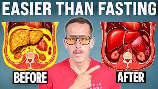 I Reversed Fatty Liver FAST – Do These 3 Things (Doctors Never Mention This)