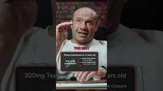 He Took 300mg of Testosterone at 14… BAD NEWS!