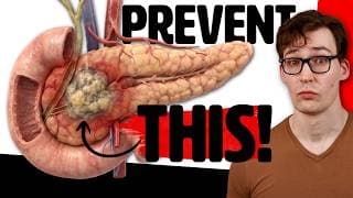 Pancreatic Cancer: 750% Increased Risk