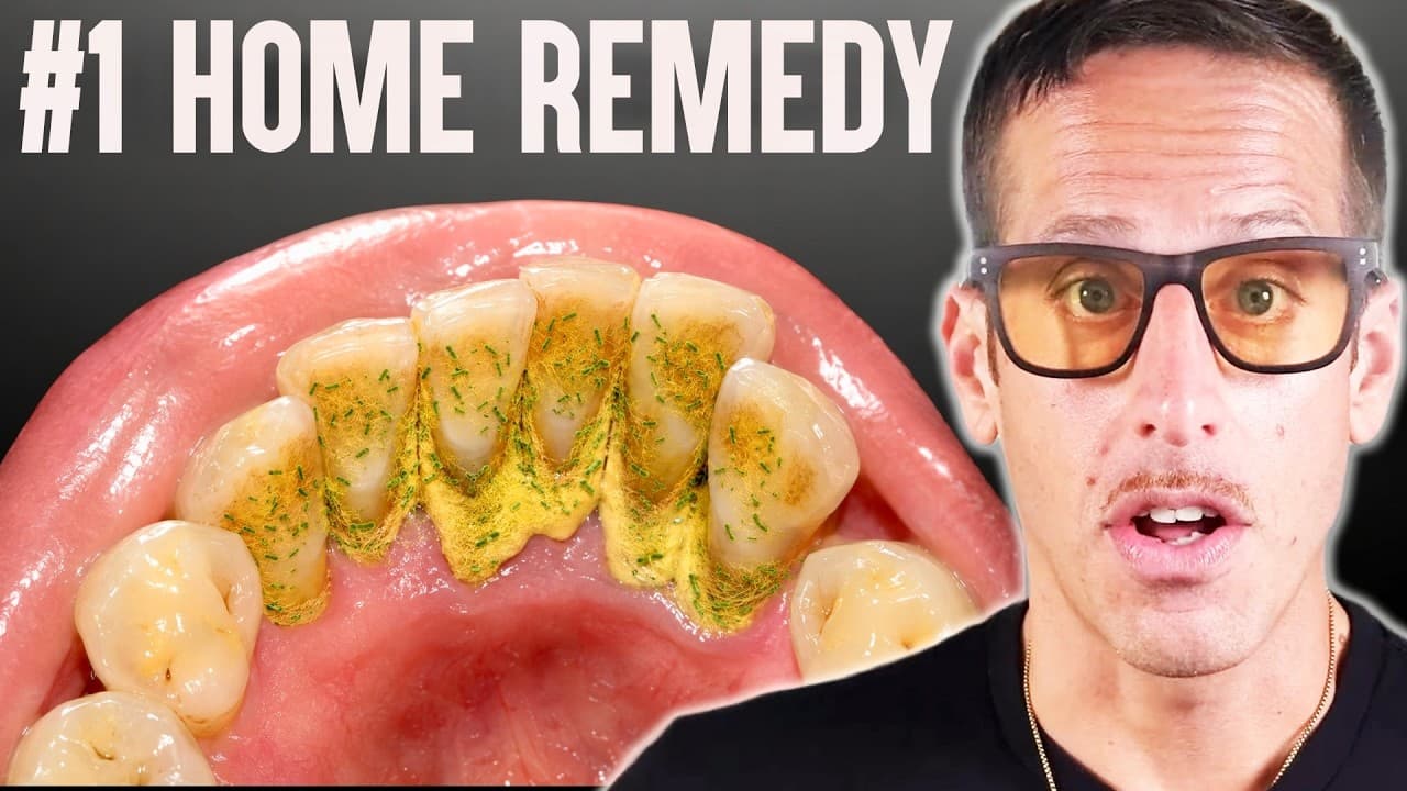 #1 Best Remedy That Removes Tartar & Plaque FAST