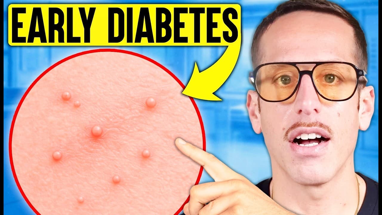 These Signs Mean Diabetes Has Already Started — Even If You Feel Fine