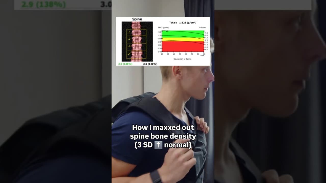 How I maxxed out spine bone density