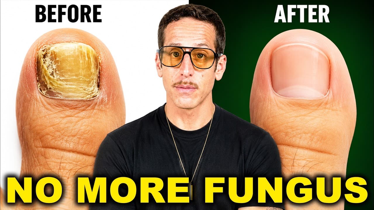 Eliminate Toenail Fungus FAST — Do This Every Night