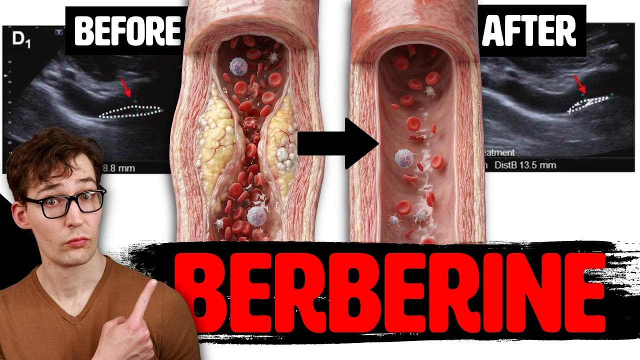 4 Months on Berberine: Reversing Arterial Plaque