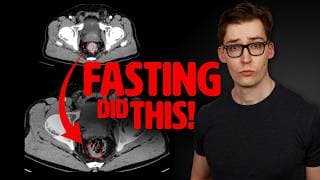 Fasting THIS many hours beat back Cancer!