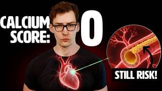 Don’t be Fooled by Coronary Artery Calcium score of 0…