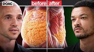 THIS Is #1 FASTEST Way To Burn Fat WITHOUT Trying