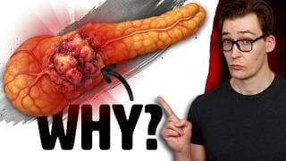Pancreatic Cancer Risk is High - Why?