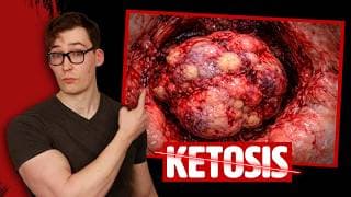 Ketosis (Fasting/Ketogenic Diet) accelerates Cancer Growth - New Study