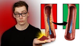 One Year of Lycopene: Reversing Arterial Plaque